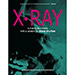 X-Ray by Ben Harris and Steve Shufton - Book