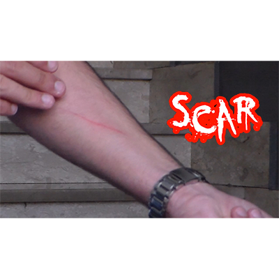 SCAR - Dan Alex - Video DOWNLOAD