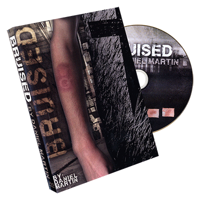 Bruised - Daniel Martin